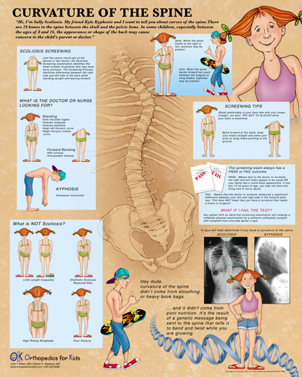 Scoliosis Poster